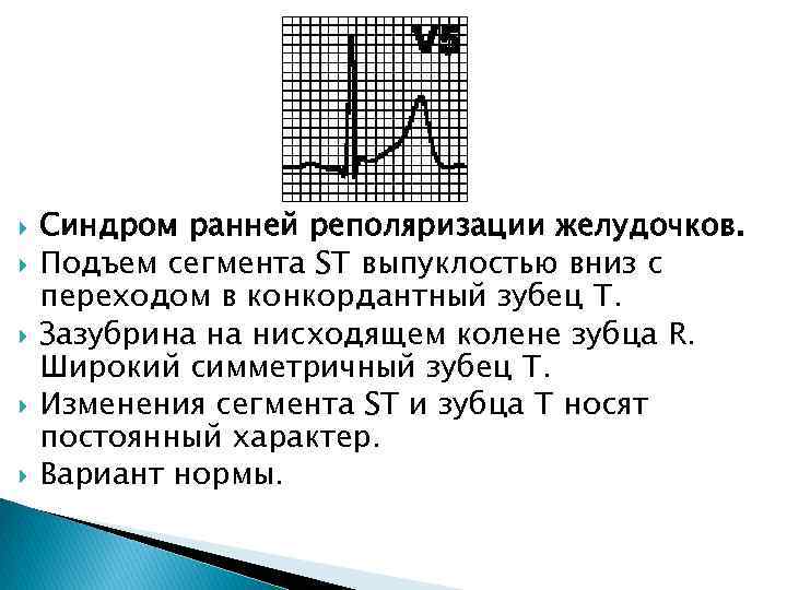 Синдром ранней реполяризации желудочков на экг. Ранняя реполяризация желудочков на ЭКГ. Ранняя реполяризация желудочков сердца на ЭКГ. ЭКГ признаки синдрома РРЖ.