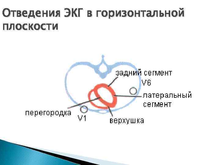 Отведения ЭКГ в горизонтальной плоскости 