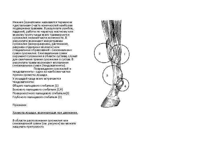 Нижняя (в анатомии называется термином «дистальная» ) часть конечностей наиболее подвержена травмам. В результате