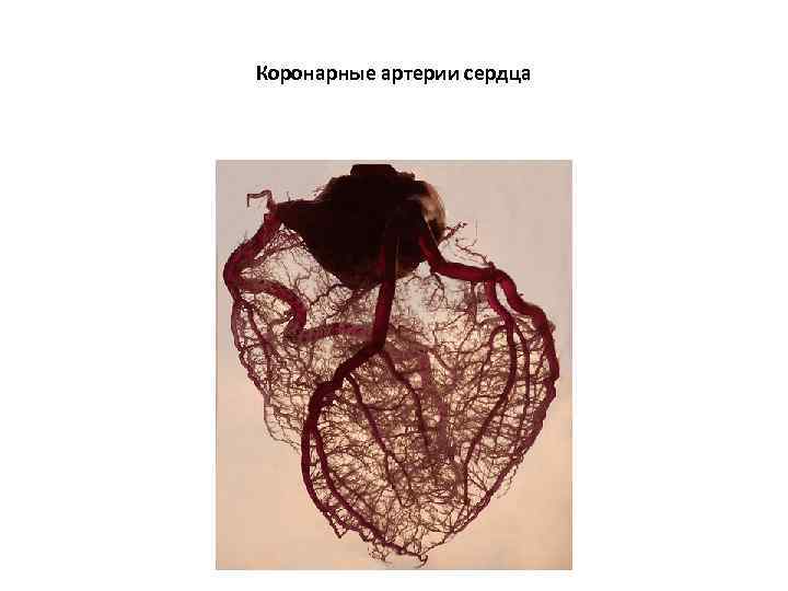 Коронарные артерии сердца 