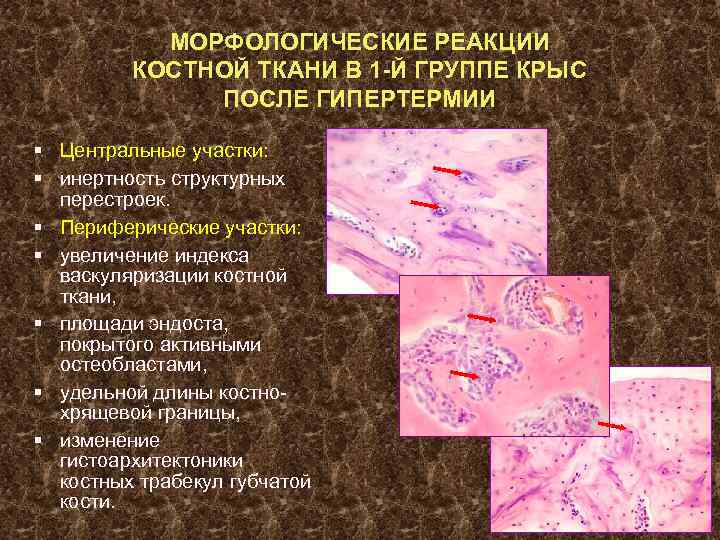 МОРФОЛОГИЧЕСКИЕ РЕАКЦИИ КОСТНОЙ ТКАНИ В 1 -Й ГРУППЕ КРЫС ПОСЛЕ ГИПЕРТЕРМИИ § Центральные участки: