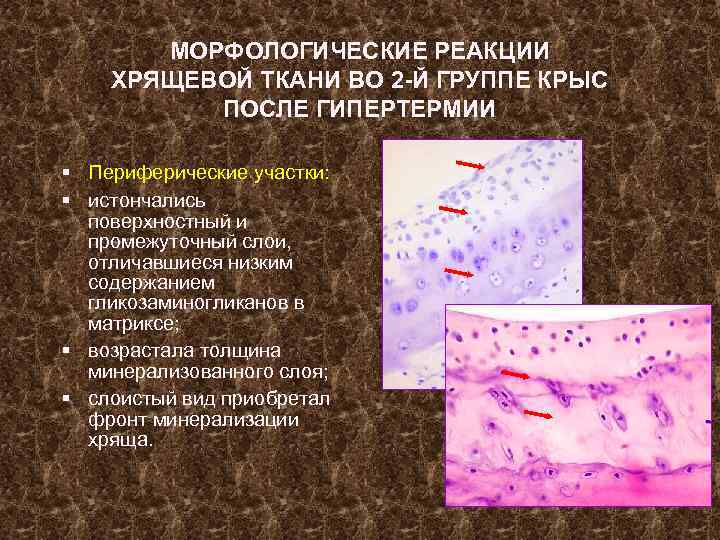 МОРФОЛОГИЧЕСКИЕ РЕАКЦИИ ХРЯЩЕВОЙ ТКАНИ ВО 2 -Й ГРУППЕ КРЫС ПОСЛЕ ГИПЕРТЕРМИИ § Периферические участки: