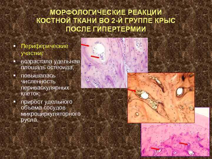 МОРФОЛОГИЧЕСКИЕ РЕАКЦИИ КОСТНОЙ ТКАНИ ВО 2 -Й ГРУППЕ КРЫС ПОСЛЕ ГИПЕРТЕРМИИ § Периферические участки: