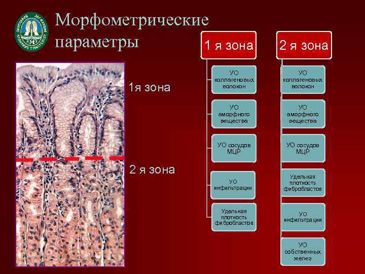 Морфометрические параметры 1 я зона 2 я зона УО коллагеновых волокон УО аморфного вещества