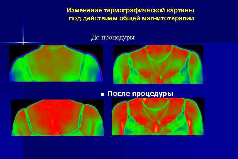 Низкочастотная магнитотерапия презентация