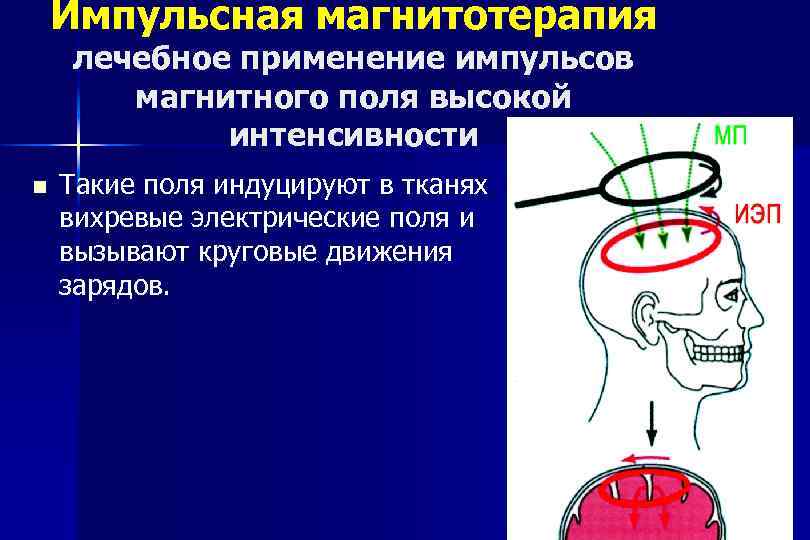 Импульсная магнитотерапия лечебное применение импульсов магнитного поля высокой интенсивности n Такие поля индуцируют в