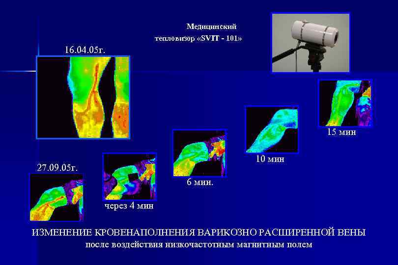 Медицинский тепловизор «SVIT - 101» 16. 04. 05 г. 15 мин 10 мин 27.