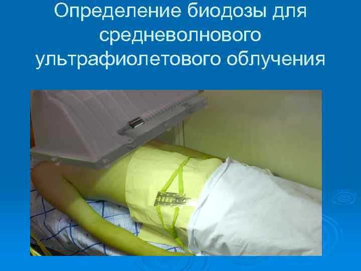 Определение биодозы для средневолнового ультрафиолетового облучения 