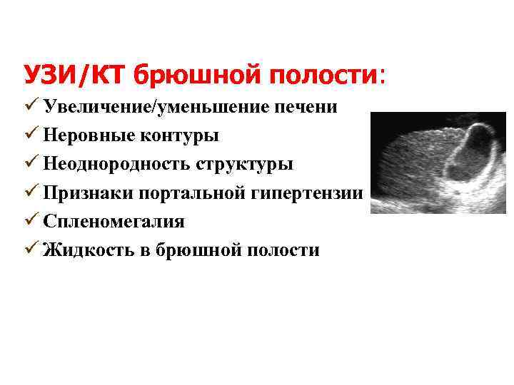 УЗИ/КТ брюшной полости: ü Увеличение/уменьшение печени ü Неровные контуры ü Неоднородность структуры ü Признаки
