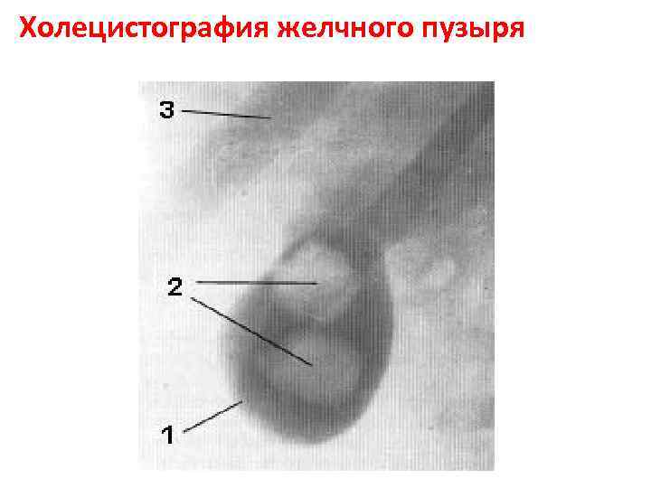 Холецистография направление образец