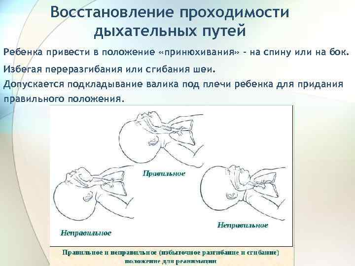 Восстановление проходимости дыхательных путей. Обеспечение проходимости дыхательных путей новорожденного. Восстановление проходимости дыхательных путей новорожденного. Восстановление проходимости дыхательных путей у детей алгоритм. Положение ребенка для восстановления проходимости дыхательных путей.