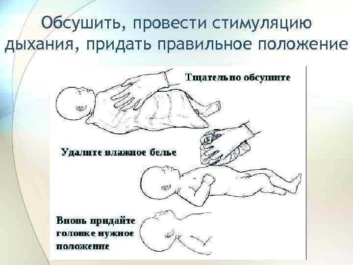 Положение детские. Положение новорожденного при реанимации. Правильное положение ребенка при реанимации. Тактильная стимуляция дыхания новорожденного. Третий этап реанимации новорожденного.