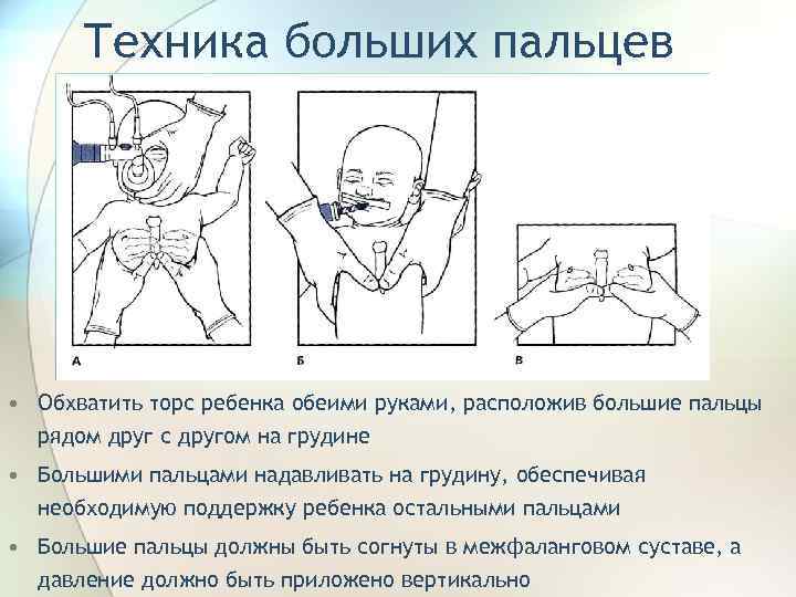 Техника больших пальцев • Обхватить торс ребенка обеими руками, расположив большие пальцы рядом друг