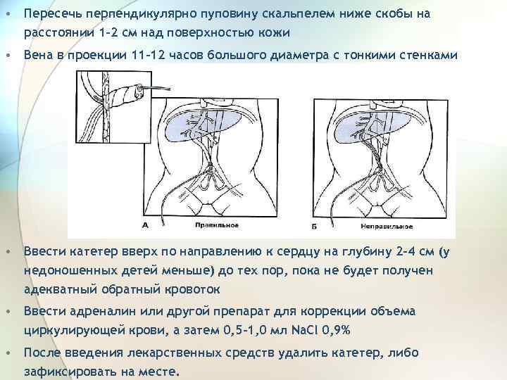  • Пересечь перпендикулярно пуповину скальпелем ниже скобы на расстоянии 1 -2 см над