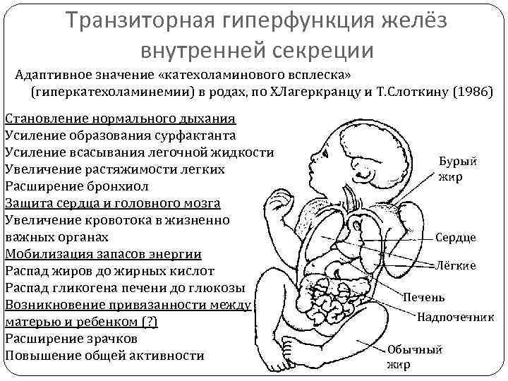 Транзиторные состояния новорожденных презентация