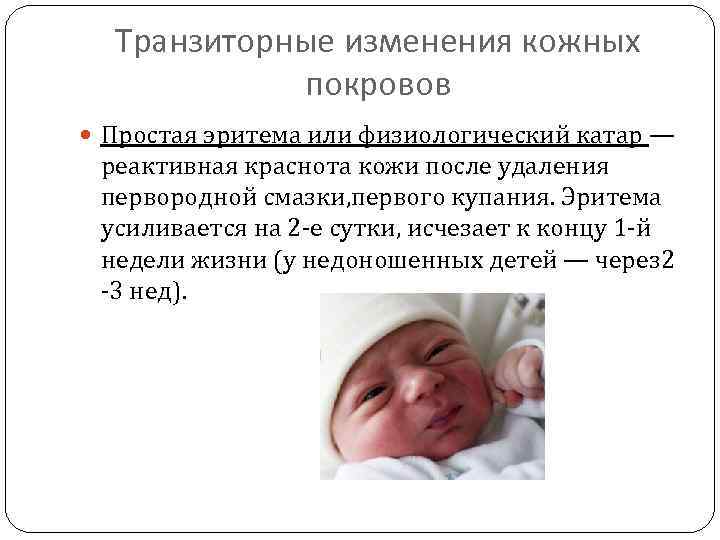 Состояние новорожденности. Транзиторные состояния новорожденных токсическая эритема. Физиологический Катар кожи (эритема новорожденных). Пограничные состояния новорожденных транзиторная эритема. Транзиторные изменения кожных покровов у новорожденных.