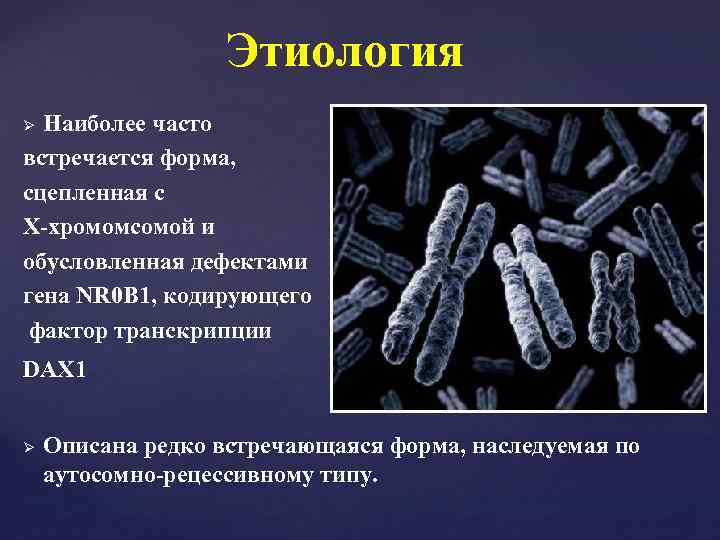 Этиология Наиболее часто встречается форма, сцепленная с Х-хромомсомой и обусловленная дефектами гена NR 0