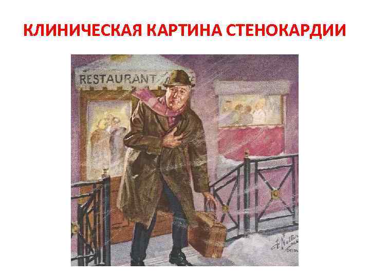 КЛИНИЧЕСКАЯ КАРТИНА СТЕНОКАРДИИ 