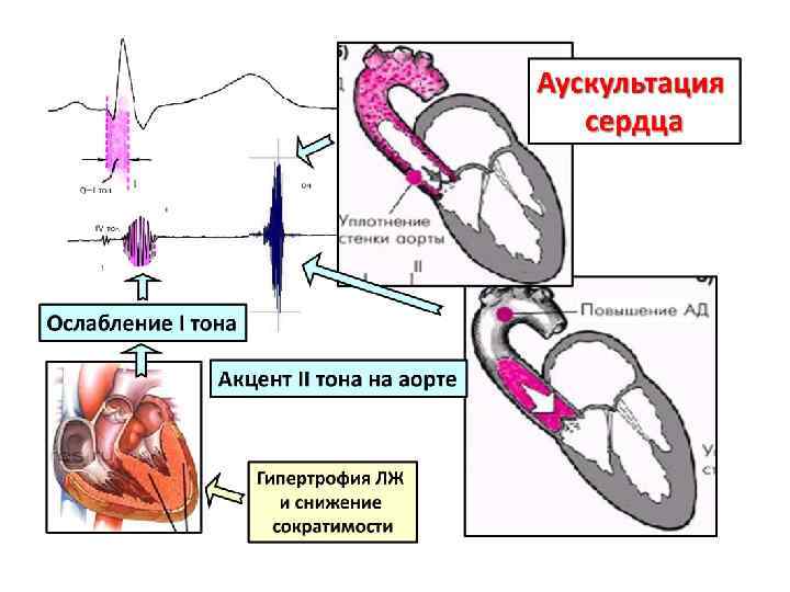 Ибс впервые возникшая стенокардия карта вызова