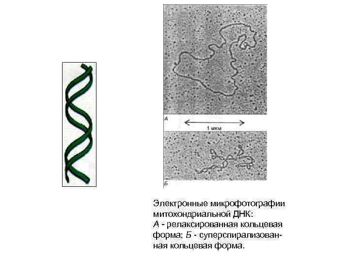Электронные микрофотографии митохондриальной ДНК: А - релаксированная кольцевая форма; Б - суперспирализованная кольцевая форма.
