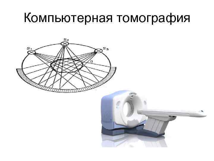 Компьютерная томография 