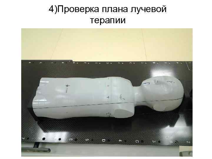 4)Проверка плана лучевой терапии 