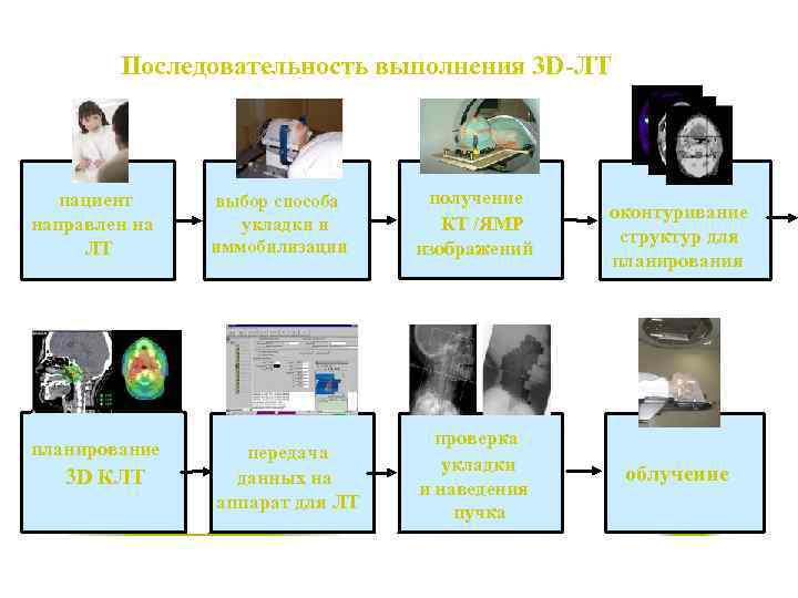 Последовательность выполнения 3 D-ЛT пациент направлен на ЛТ выбор способа укладки и иммобилизации получение