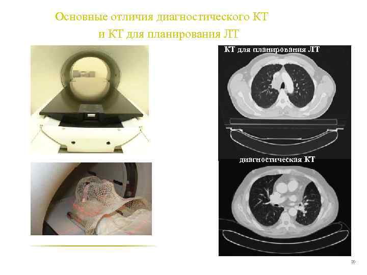 Основные отличия диагностического КТ и КТ для планирования ЛТ диагностическая КТ 20 