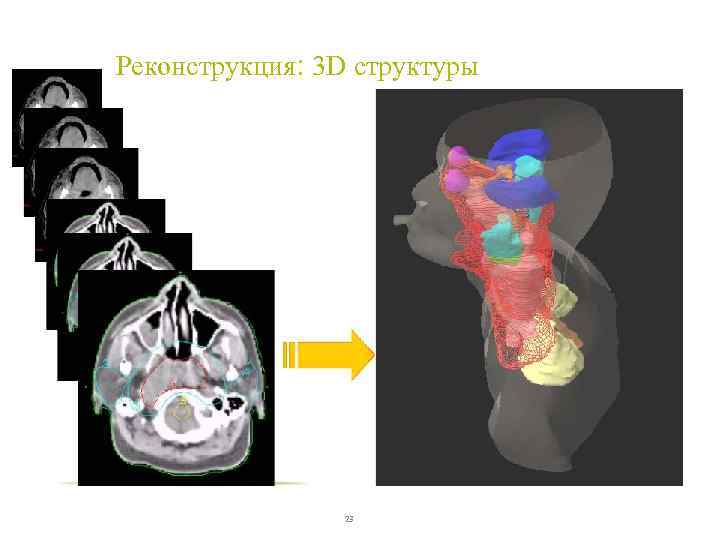 Реконструкция: 3 D структуры 23 