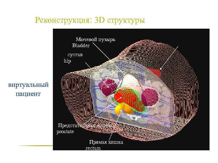 Реконструкция: 3 D структуры Мочевой пузырь Bladder сустав hip виртуальный пациент Предстательная железа prostate