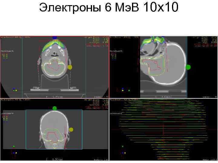 Электроны 6 Мэ. В 10 х10 