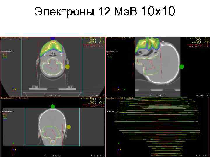 Электроны 12 Мэ. В 10 х10 