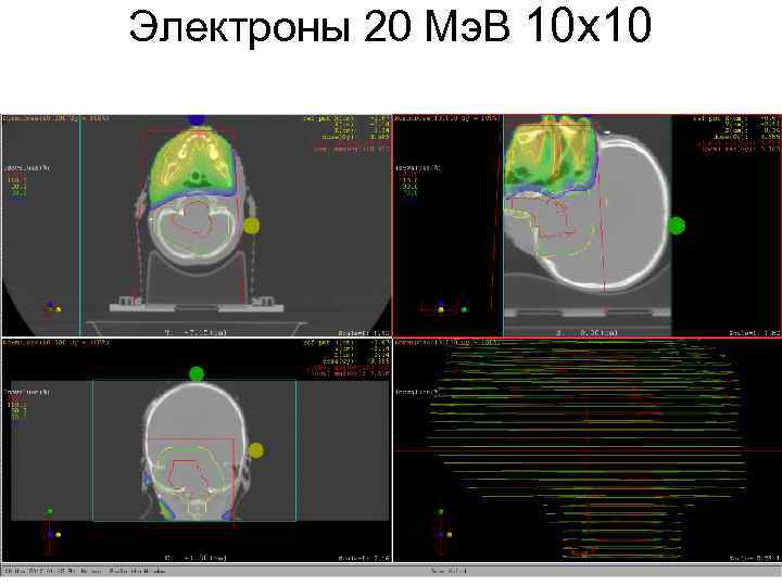Электроны 20 Мэ. В 10 х10 