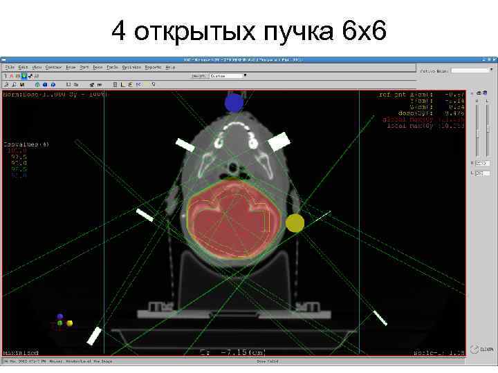 4 открытых пучка 6 х6 