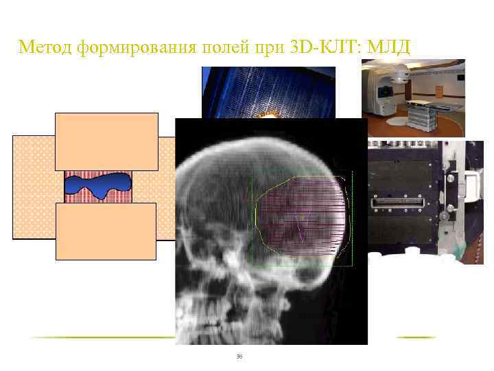 Метод формирования полей при 3 D-КЛT: МЛД 36 