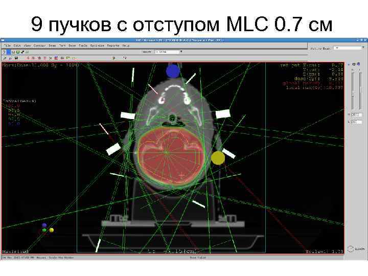9 пучков с отступом MLC 0. 7 см 