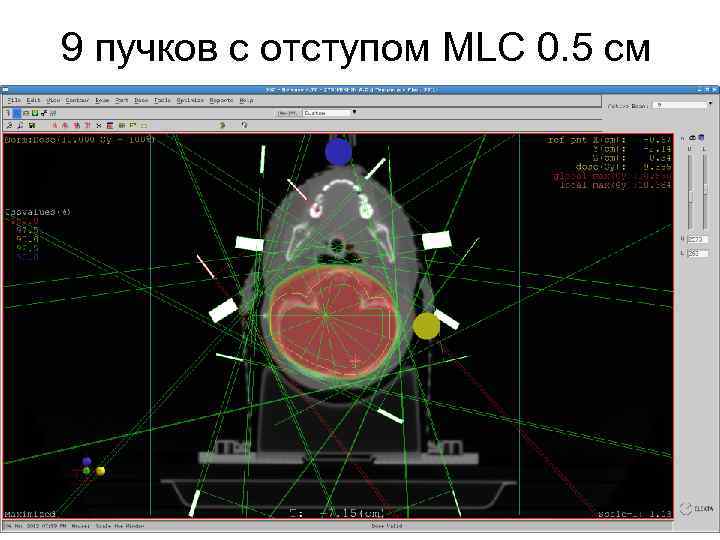 9 пучков с отступом MLC 0. 5 см 