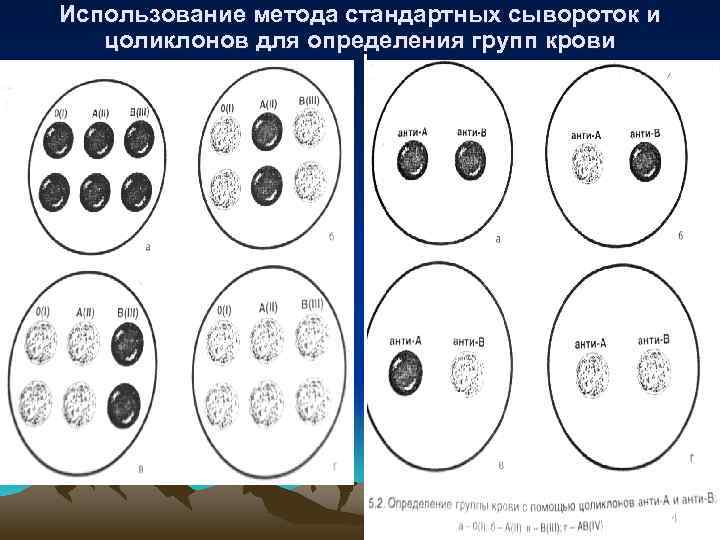 Использование метода стандартных сывороток и цоликлонов для определения групп крови 14 