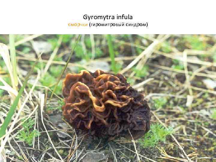 Gyromytra infula cморчки (гиромитровый синдром) 