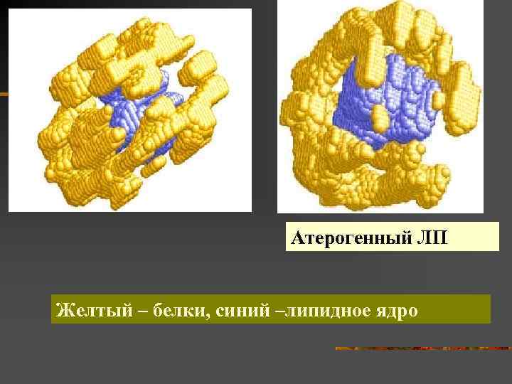 Атерогенный ЛП Желтый – белки, синий –липидное ядро 