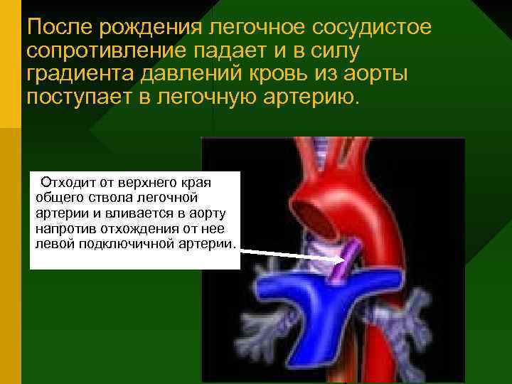 После рождения легочное сосудистое сопротивление падает и в силу градиента давлений кровь из аорты