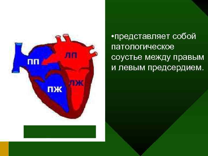  • представляет собой патологическое соустье между правым и левым предсердием. 