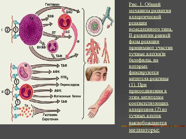 Рис. 1. Общий механизм развития аллергической реакции немедленного типа, В развитии ранней фазы реакции
