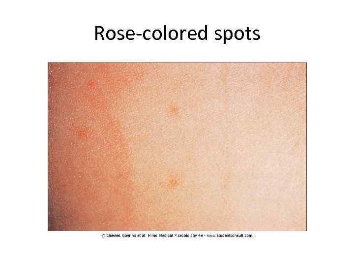 Rose-colored spots 