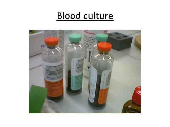 Blood culture 