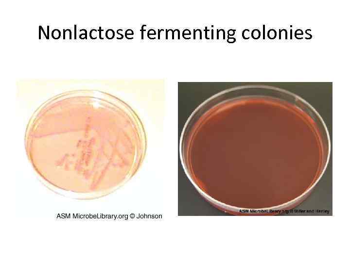 Nonlactose fermenting colonies 