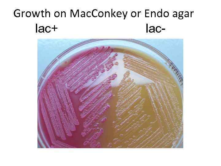 Growth on Mac. Conkey or Endo agar lac+ lac- 