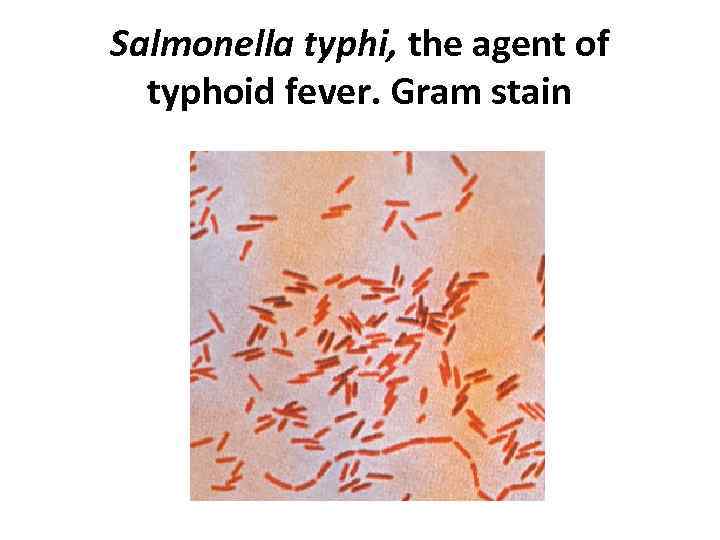 Salmonella typhi, the agent of typhoid fever. Gram stain 