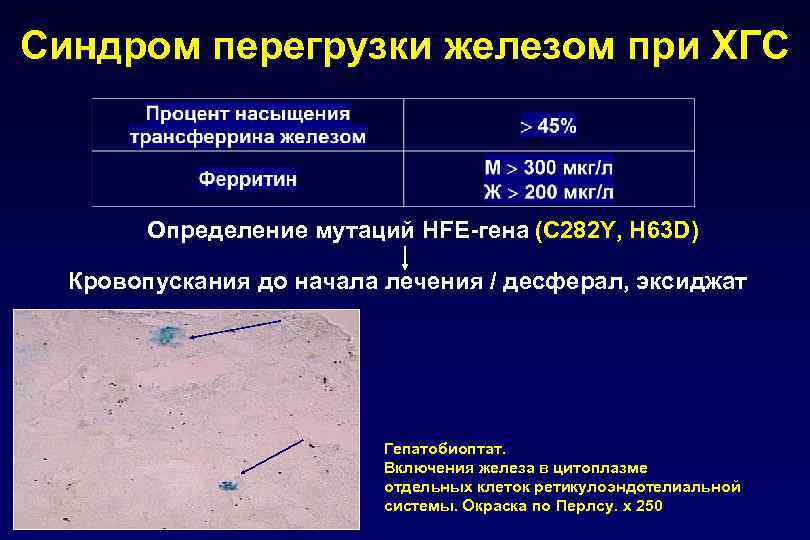 Синдром перегрузки железом при ХГС Определение мутаций HFE-гена (C 282 Y, H 63 D)