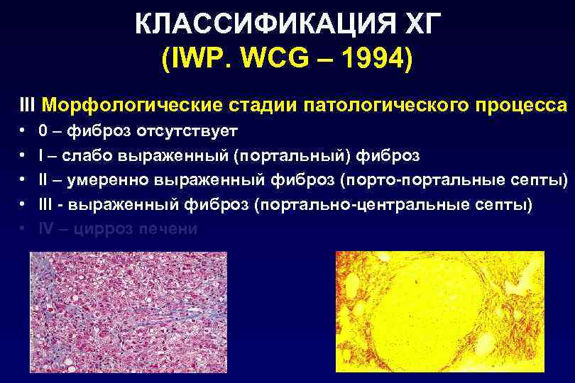 КЛАССИФИКАЦИЯ ХГ (IWP. WCG – 1994) III Морфологические стадии патологического процесса • • •